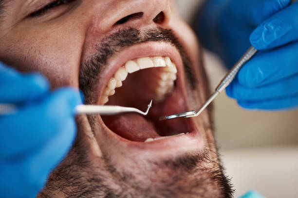 Best Emergency Dental Care for Sports Injuries in Vley Grande, AL